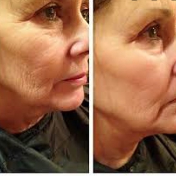 Forevers Award-Winning Infinite Firming Serum - Picture 5 of 5